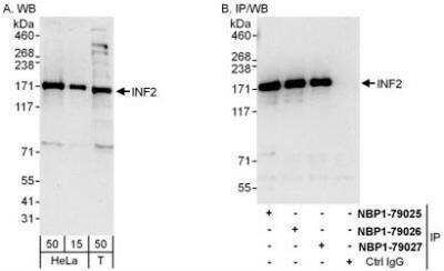 Western Blot INF2 Antibody