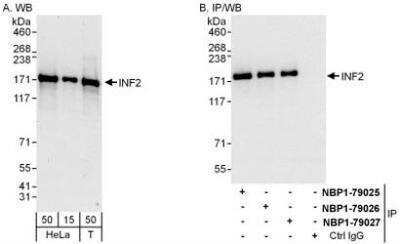 Western Blot: INF2 Antibody [NBP1-79026] - Whole cell lysate from HeLa (15 and 50 mcg for WB; 1 mg for IP, 20% of IP loaded) and 293T (T; 50 mcg) cells.  Antibodies: Affinity purified rabbit anti-INF2 antibody  used for WB at 0.04 mcg/ml (A) and 0.4 mcg/ml (B) and used for IP at 6 mcg/mg lysate.  INF2 was also immunoprecipitated by rabbit anti-INF2 antibodies NBP1-79025 andNBP1-79027, which recognize other epitopes.