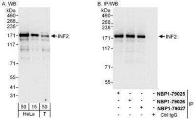 Western Blot INF2 Antibody