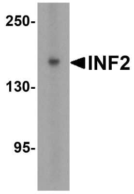 Western Blot: INF2 Antibody [NBP2-81836] - Western blot analysis of INF2 in (A) human tonsil and (B) rat stomach tissue lysate with INF2 antibody at 1 ug/mL.