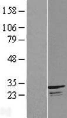 Western Blot: INF2 Overexpression Lysate (Adult Normal) [NBL1-08180] Left-Empty vector transfected control cell lysate (HEK293 cell lysate); Right -Over-expression Lysate for INF2.