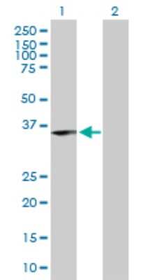 Western Blot: ING1 Antibody [H00003621-D01P] - Analysis of ING1 expression in transfected 293T cell line by ING1 polyclonal antibody.Lane 1: ING1 transfected lysate(31.90 KDa).Lane 2: Non-transfected lysate.