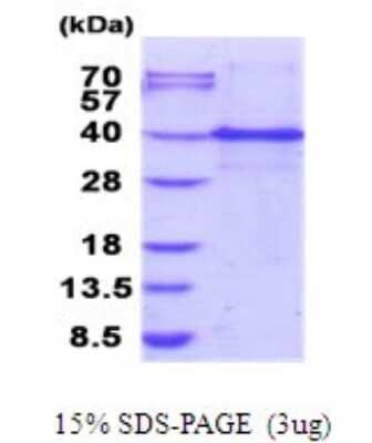 SDS-Page: ING1 Recombinant Protein [NBP2-51900] - 15% SDS Page (3 ug)