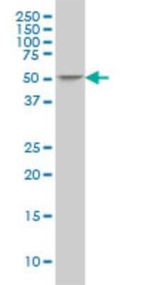 Western Blot: ING3 Antibody (2C4) [H00054556-M02] - ING3 monoclonal antibody (M02), clone 2C4 Analysis of ING3 expression in PC-12.