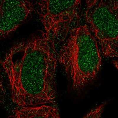 Immunocytochemistry/Immunofluorescence: ING3 Antibody [NBP3-05525] - Staining of human cell line HEK 293 shows localization to nucleus.