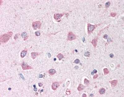 Immunohistochemistry-Paraffin: ING3 Antibody [NBP1-02460] - Staining of human brain, cortex. Immunohistochemistry of formalin-fixed, paraffin-embedded tissue after heat-induced antigen retrieval. Antibody concentration 5 ug/mL.