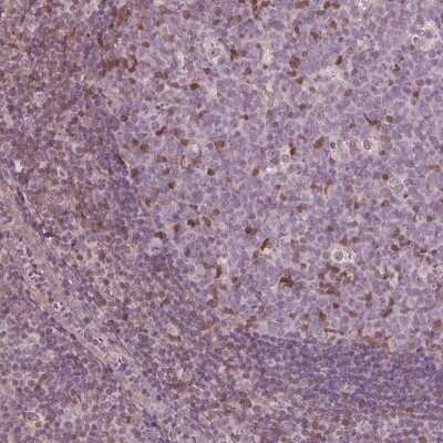 Immunohistochemistry-Paraffin: ING3 Antibody [NBP3-05524] - Staining of human lymph node shows moderate nuclear positivity in subset of germinal and non-germinal center cells.