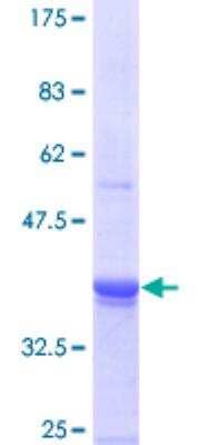 SDS-Page: ING3 Recombinant Protein [H00054556-P01] - 12.5% SDS-PAGE Stained with Coomassie Blue.