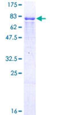 SDS-Page: ING3 Recombinant Protein [H00054556-P02] - 12.5% SDS-PAGE Stained with Coomassie Blue.