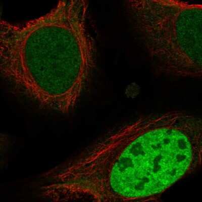 Immunocytochemistry/Immunofluorescence: ING4 Antibody [NBP2-55457] - Staining of human cell line U-2 OS shows localization to nucleoplasm.