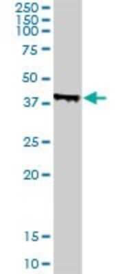 Western Blot: ING4 Antibody [H00051147-B01P] - Analysis of ING4 expression in A-431.