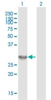 Western Blot: ING4 Antibody [H00051147-B01P] - Analysis of ING4 expression in transfected 293T cell line by ING4 polyclonal antibody.  Lane 1: ING4 transfected lysate(27.39 KDa). Lane 2: Non-transfected lysate.