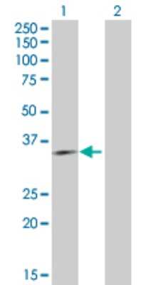 Western Blot: ING4 Antibody [H00051147-D01P] - Analysis of ING4 expression in transfected 293T cell line by ING4 polyclonal antibody.Lane 1: ING4 transfected lysate(28.50 KDa).Lane 2: Non-transfected lysate.