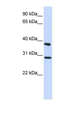 Western Blot: ING4 Antibody [NBP1-79383] - 293T cells lysate, concentration 0.2-1 ug/ml.