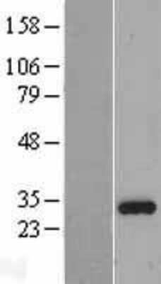 Western Blot: ING4 Overexpression Lysate (Adult Normal) [NBL1-11992] Left-Empty vector transfected control cell lysate (HEK293 cell lysate); Right -Over-expression Lysate for ING4.