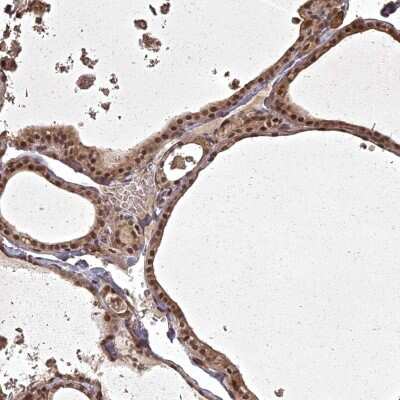 Immunohistochemistry-Paraffin: ING5 Antibody [NBP3-05519] - Staining of human thyroid gland shows distinct cytoplasmic and nuclear positivity in glandular cells.