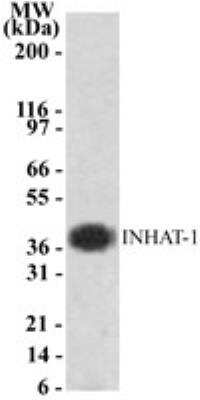 Western Blot: INHAT-1 Antibody [NB100-56353] - Analysis of INHAT-1 In Jurkat cell lysate