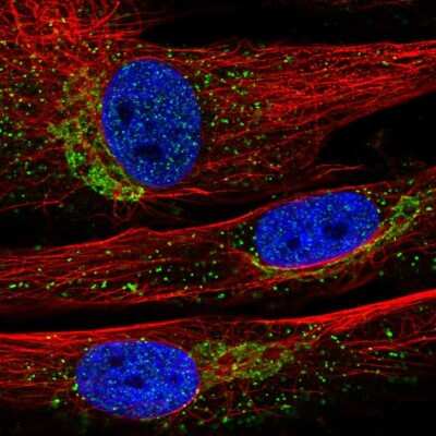 Immunocytochemistry/Immunofluorescence: INMT Antibody [NBP2-57073] - Staining of human cell line BJ shows localization to the Golgi apparatus & vesicles.