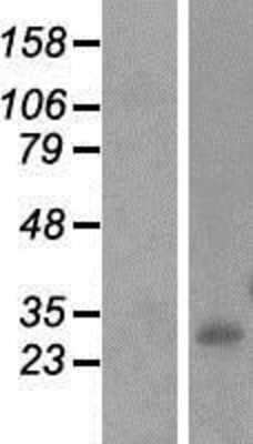 Western Blot: INMT Overexpression Lysate (Adult Normal) [NBP2-07583] Left-Empty vector transfected control cell lysate (HEK293 cell lysate); Right -Over-expression Lysate for INMT.