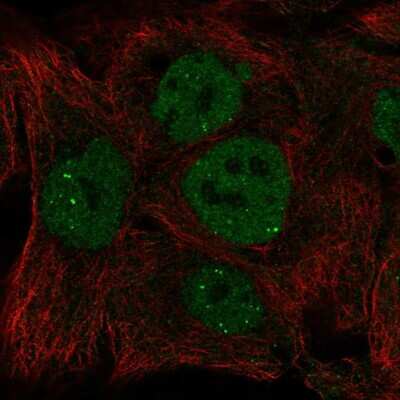 Immunocytochemistry/Immunofluorescence: INO80 Antibody [NBP2-58955] - Staining of human cell line HaCaT shows localization to nucleoplasm & nuclear bodies.