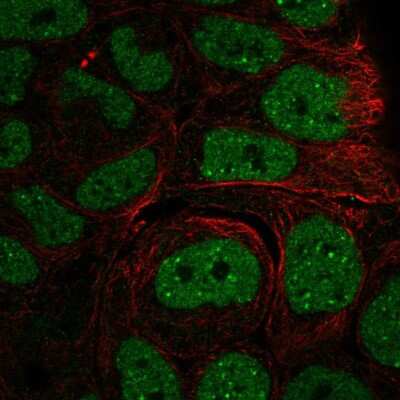 Immunocytochemistry/Immunofluorescence: INO80 Antibody [NBP2-58963] - Staining of human cell line RT4 shows localization to nucleoplasm & nuclear bodies.