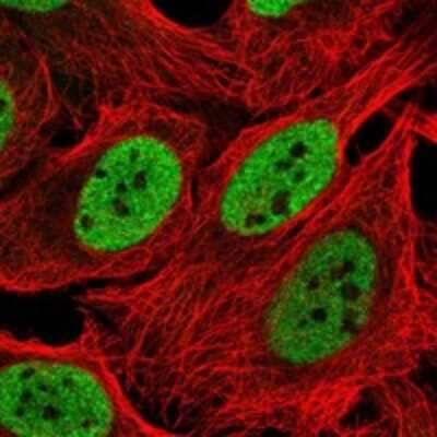 Immunocytochemistry/Immunofluorescence: INO80 Antibody [NBP3-17871] - Staining of human cell line U-2 OS shows localization to nucleoplasm.