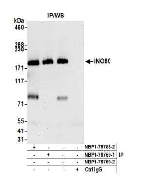 Immunoprecipitation: INO80 Antibody [NBP1-78758] - Detection of human INO80 by western blot of immunoprecipitates. Samples: Whole cell lysate (1.0 mg per IP reaction; 20% of IP loaded) from Jurkat cells prepared using NETN lysis buffer. Antibodies: Affinity purified rabbit anti-INO80 antibody NBP1-78758 lot 2 used for IP at 6 ug per reaction. INO80 was also immunoprecipitated by rabbit anti-INO80 antibody NBP1-78759. For blotting immunoprecipitated INO80, NBP1-78759 was used at 0.04 ug/ml. Detection: Chemiluminescence with an exposure time of 30 seconds.