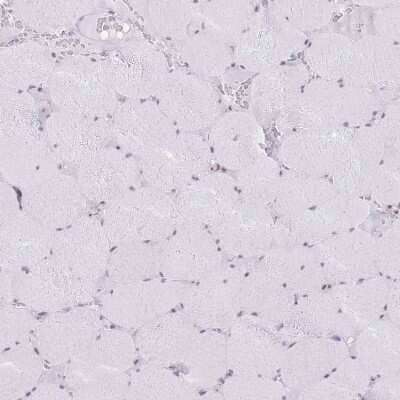 Immunohistochemistry-Paraffin: INO80C Antibody [NBP2-14123] - Staining of human skeletal muscle shows very weak positivity in myocytes.