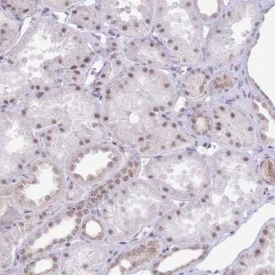 Immunohistochemistry-Paraffin: INO80C Antibody [NBP2-14123] - Staining of human kidney shows weak to moderate positivity in cells in tubules.