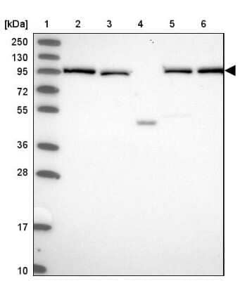 Western Blot: INO80D Antibody [NBP1-93981] - Lane 1: Marker  [kDa] 250, 130, 95, 72, 55, 36, 28, 17, 10.  Lane 2: Human cell line RT-4.  Lane 3: Human cell line U-251MG sp.  Lane 4: Human plasma (IgG/HSA depleted).  Lane 5: Human liver tissue.  Lane 6: Human tonsil tissue