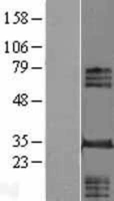 Western Blot: INO80E Overexpression Lysate (Adult Normal) [NBL1-08834] Left-Empty vector transfected control cell lysate (HEK293 cell lysate); Right -Over-expression Lysate for INO80E.