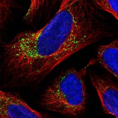 Immunocytochemistry/Immunofluorescence: INPP1 Antibody [NBP2-48662] - Staining of human cell line U-2 OS shows localization to vesicles.