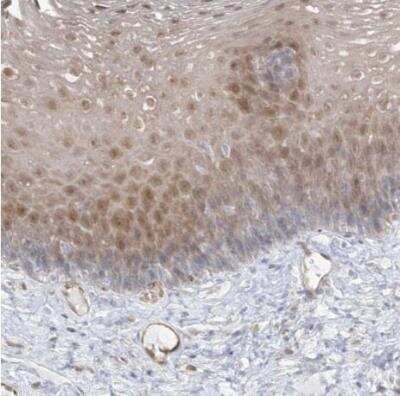 Immunohistochemistry-Paraffin: INPP1 Antibody [NBP1-85889] - Staining of human esophagus shows cytoplasmic and a few cases of nuclear positivity in squamous epithelial cells.