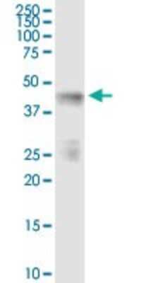 Immunoprecipitation: INPP1 Antibody [H00003628-D01P] - Analysis of INPP1 transfected lysate using anti-INPP1 rabbit polyclonal antibody and Protein Magnetic Bead, and immunoblotted with INPP1 purified mouse polyclonal antibody (B01P).