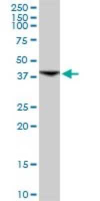 Western Blot: INPP1 Antibody [H00003628-D01P] - Analysis of INPP1 expression in human pancreas.