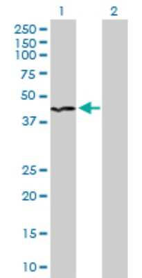 Western Blot: INPP1 Antibody [H00003628-D01P] - Analysis of INPP1 expression in transfected 293T cell line by INPP1 polyclonal antibody.Lane 1: INPP1 transfected lysate(44.00 KDa).Lane 2: Non-transfected lysate.