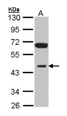 Western Blot: INPP1 Antibody [NBP1-31475] - Sample (30 ug of whole cell lysate) A: Raji 10% SDS PAGE; antibody diluted at 1:1000.