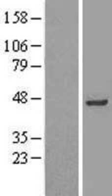 Western Blot: INPP1 Overexpression Lysate (Adult Normal) [NBL1-11997] Left-Empty vector transfected control cell lysate (HEK293 cell lysate); Right -Over-expression Lysate for INPP1.