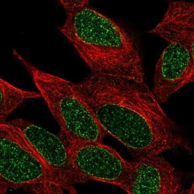 Immunocytochemistry/ Immunofluorescence INPP4A Antibody - BSA Free