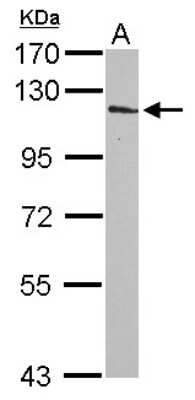 Western Blot: INPP4A Antibody [NBP2-16968] - Sample (30 ug of whole cell lysate) A: NT2D1 7. 5% SDS PAGE gel, diluted at 1:1000.