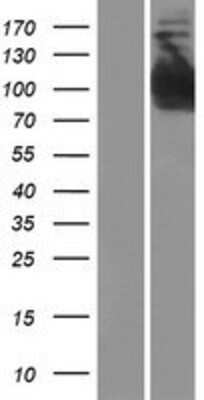 Western Blot: INPP4B Overexpression Lysate (Adult Normal) [NBP2-08265] Left-Empty vector transfected control cell lysate (HEK293 cell lysate); Right -Over-expression Lysate for INPP4B.