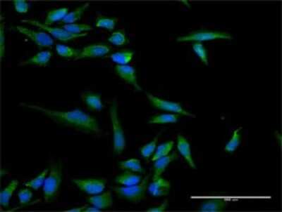 Immunocytochemistry/Immunofluorescence: INPP5B Antibody [H00003633-D01P] - Analysis of antibody to INPP5B on HeLa cell. Antibody concentration 30 ug/ml.