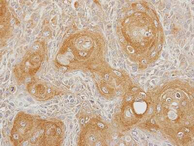Immunohistochemistry-Paraffin: INPP5B Antibody [NBP1-31705] - Paraffin-embedded Ca922 xenograft, using antibody at 1:100 dilution.