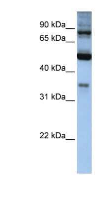 Western Blot: INPP5B Antibody [NBP1-54719] - Hela cell lysate, concentration 0.2-1 ug/ml.