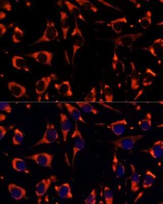 Immunocytochemistry/ Immunofluorescence INPP5E Antibody - Azide and BSA Free