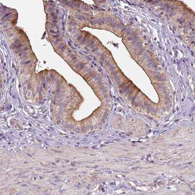 Immunohistochemistry-Paraffin: INPP5E Antibody [NBP2-49463] - Staining of human gallbladder shows moderate cytoplasmic positivity in glandular cells.