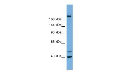 Western Blot: INPP5F Antibody [NBP2-84093] - Host: Rabbit. Target Name: INPP5F. Sample Type: NCI-H226 Whole cell lysates. Antibody Dilution: 1.0ug/ml