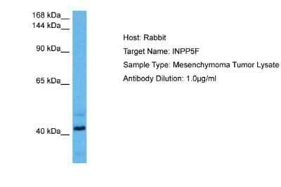 Western Blot: INPP5F Antibody [NBP2-84094] - Host: Rabbit. Target Name: INPP5F. Sample Tissue: Human Mesenchymoma Tumor lysates. Antibody Dilution: 1ug/ml