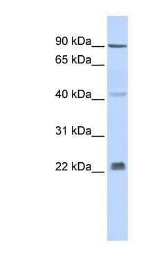 Western Blot: INSIG-2 Antibody [NBP1-59687] - Human Muscle lysate, concentration 0.2-1 ug/ml.