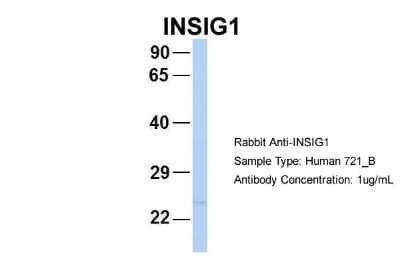 Western Blot INSIG-2 Antibody